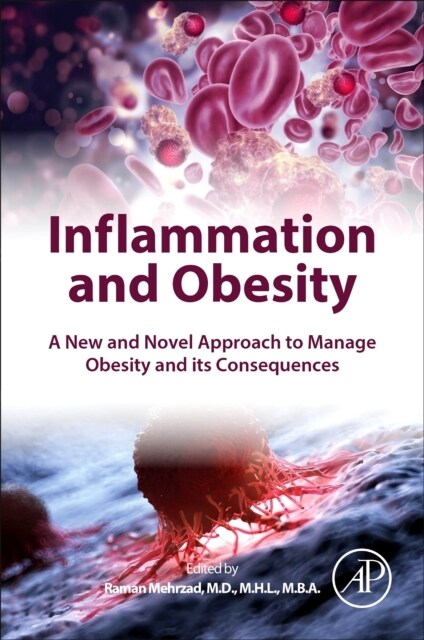 Inflammation and Obesity : A New and Novel Approach to Manage Obesity and its Consequences (Paperback)