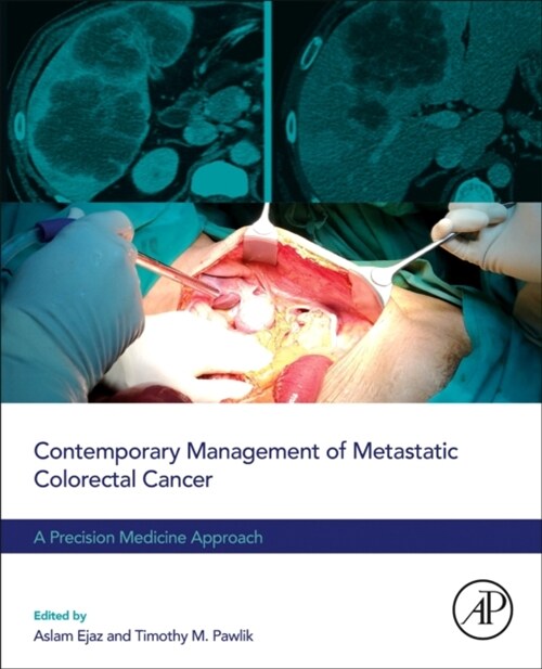 Contemporary Management of Metastatic Colorectal Cancer : A Precision Medicine Approach (Paperback)