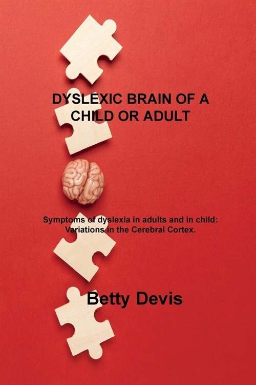 Dyslexic Brain of a Child or Adult: Symptoms of dyslexia in adults and in child: Variations in the Cerebral Cortex. (Paperback)