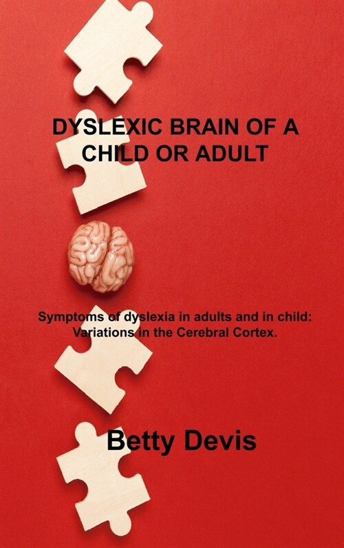 Dyslexic Brain of a Child or Adult: Symptoms of dyslexia in adults and in child: Variations in the Cerebral Cortex. (Hardcover)