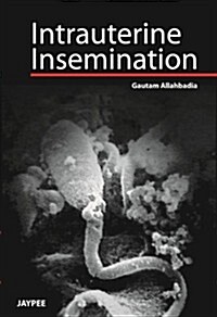 Intrauterine Insemination (Hardcover, 2)