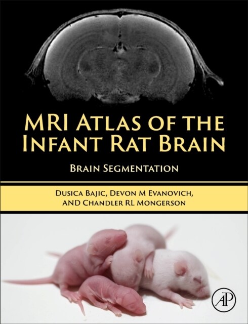 MRI Atlas of the Infant Rat Brain : Brain Segmentation (Hardcover)