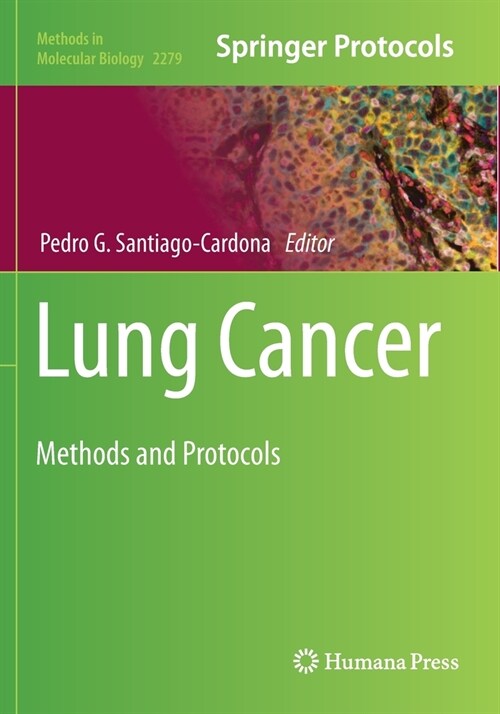 Lung Cancer: Methods and Protocols (Paperback)