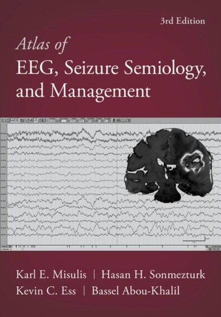 Atlas of Eeg, Seizure Semiology, and Management (Hardcover, 3)