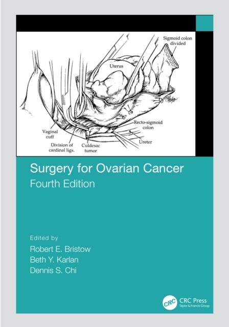 Surgery for Ovarian Cancer (Hardcover, 4 ed)