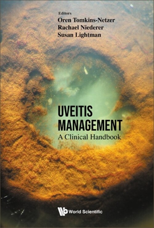 Uveitis Management: A Clinical Handbook (Hardcover)