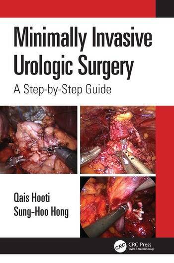 Minimally Invasive Urologic Surgery : A Step-by-Step Guide (Paperback)