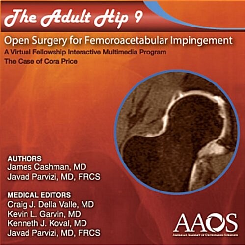 The Adult Hip - Case 9 Open Surgical Treatment of Femoroacetabular Impingement (DVD)