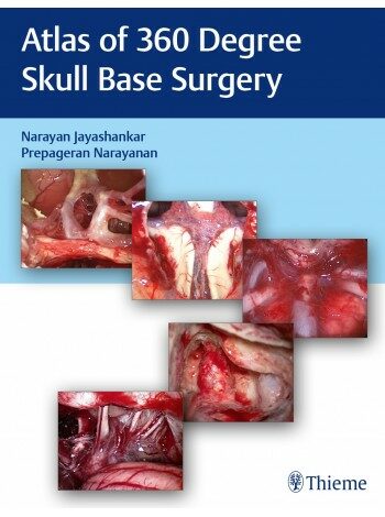 Atlas of 360 Degree Skull Base Surgery (Hardcover)