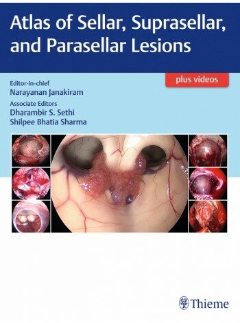 Atlas of Sellar, Suprasellar, and Parasellar Lesions (Hardcover)