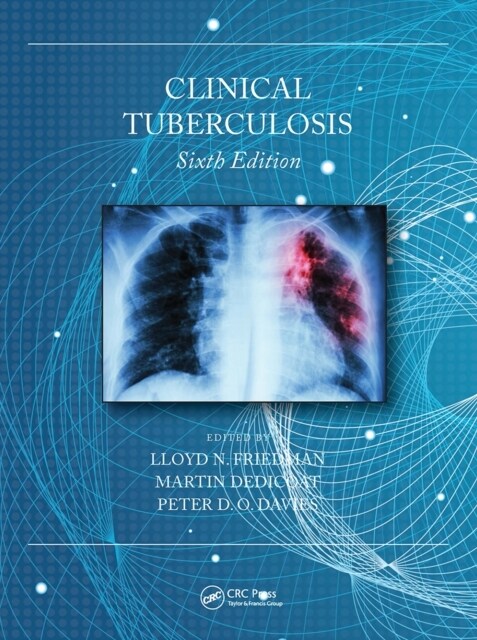 Clinical Tuberculosis (Paperback, 6 ed)
