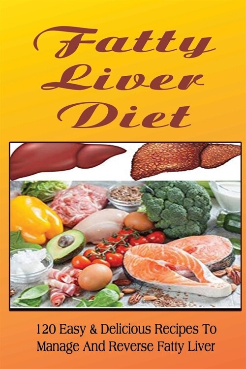 Fatty Liver Diet: 120 Easy & Delicious Recipes To Manage And Reverse Fatty Liver (Paperback)