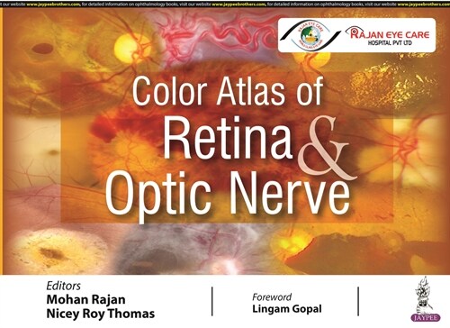 Color Atlas of Retina & Optic Nerve (Hardcover)