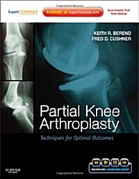 Partial Knee Arthroplasty: Techniques for Optimal Outcomes (Hardcover, 1st)