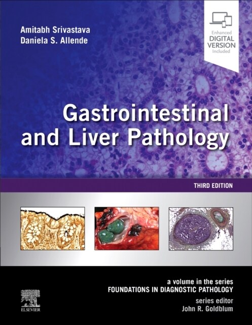 Gastrointestinal and Liver Pathology: A Volume in the Series: Foundations in Diagnostic Pathology (Hardcover, 3)