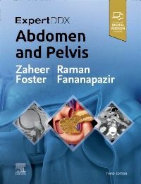 Expertddx: Abdomen and Pelvis (Hardcover, 3)