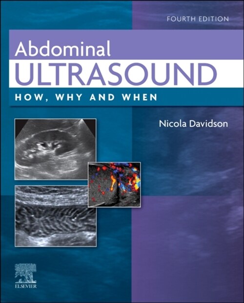 Abdominal Ultrasound : How, Why and When (Hardcover, 4 ed)
