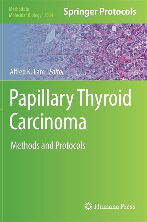 Papillary Thyroid Carcinoma: Methods and Protocols (Hardcover)