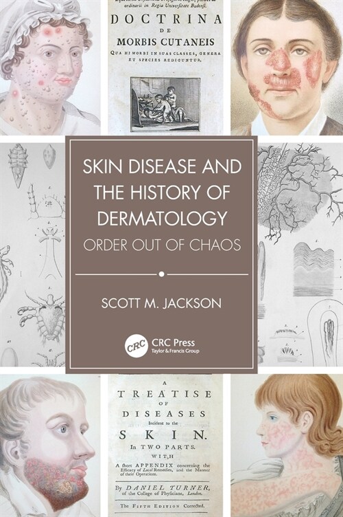 Skin Disease and the History of Dermatology : Order out of Chaos (Hardcover)