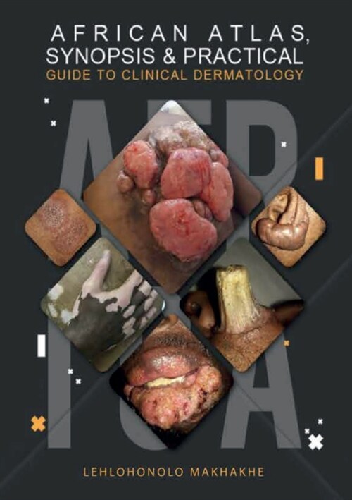 African Atlas, Synopsis & Practical Guide to Clinical Dermatology (Paperback)
