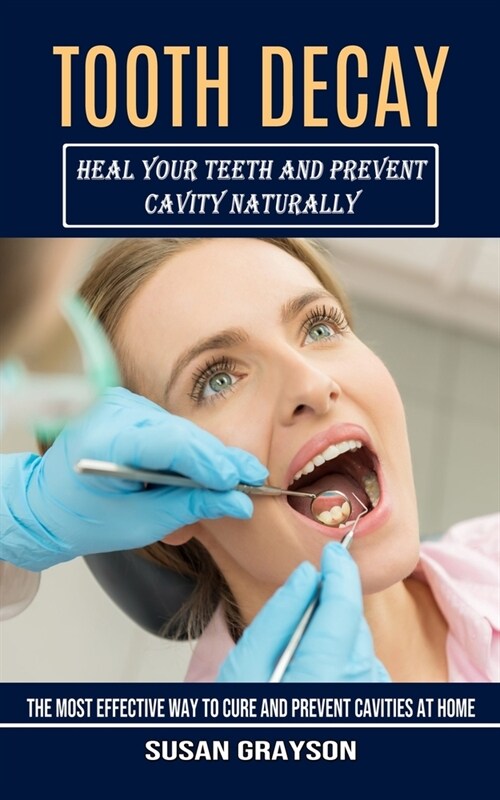 Tooth Decay: Heal Your Teeth and Prevent Cavity Naturally (The Most Effective Way to Cure and Prevent Cavities at Home) (Paperback)