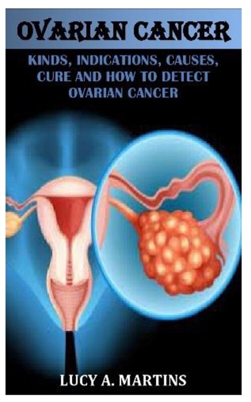 Ovarian Cancer: Kinds, Indications, Causes, Cure and How to Detect Ovarian Cancer (Paperback)