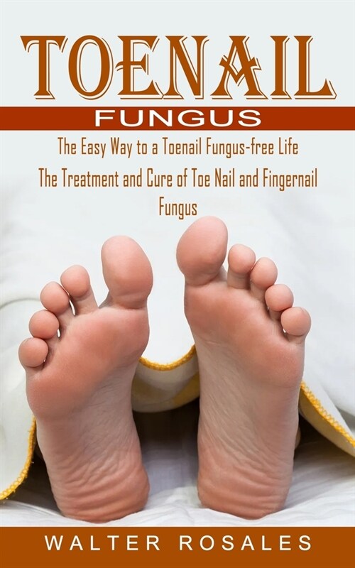 Toenail Fungus: The Easy Way to a Toenail Fungus-free Life (The Treatment and Cure of Toe Nail and Fingernail Fungus) (Paperback)