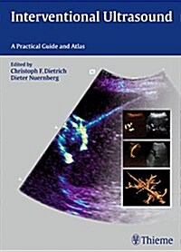 Interventional Ultrasound: A Practical Guide and Atlas (Hardcover)