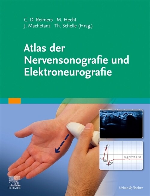 Atlas der Nervensonografie und Elektroneurografie (Hardcover)