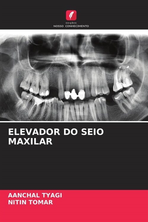 ELEVADOR DO SEIO MAXILAR (Paperback)