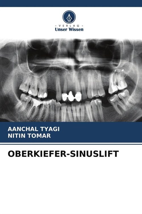 OBERKIEFER-SINUSLIFT (Paperback)