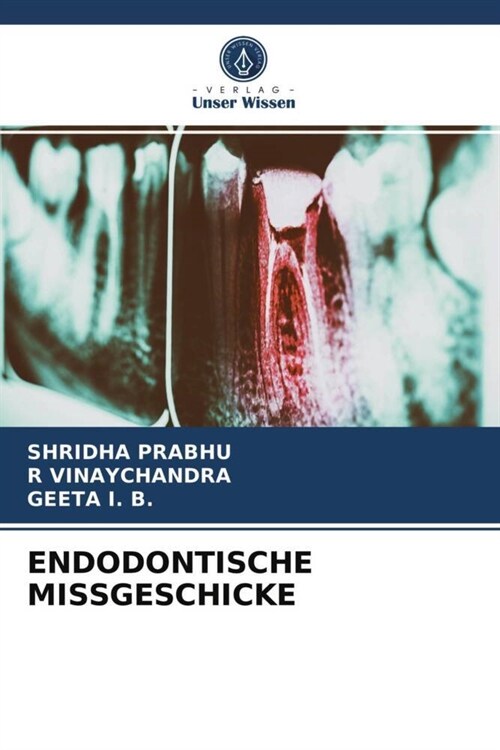 ENDODONTISCHE MISSGESCHICKE (Paperback)