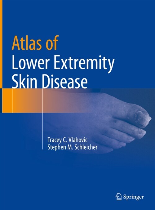 Atlas of Lower Extremity Skin Disease (Hardcover)