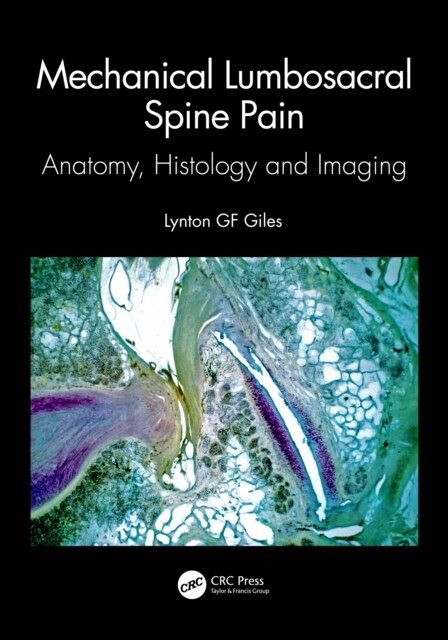 Mechanical Lumbosacral Spine Pain : Anatomy, Histology and Imaging (Paperback)