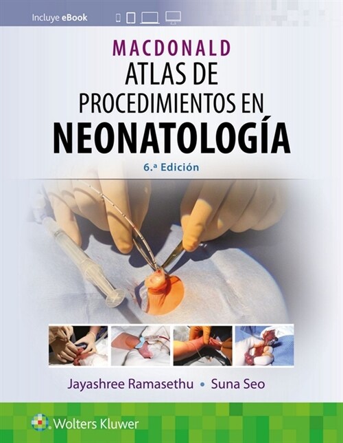 Macdonald. Atlas de Procedimientos En Neonatolog? (Paperback, 6)