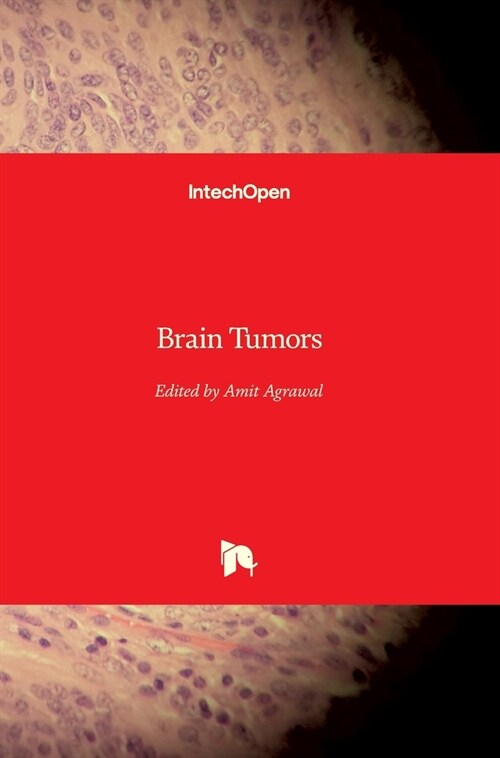 Brain Tumors (Hardcover)