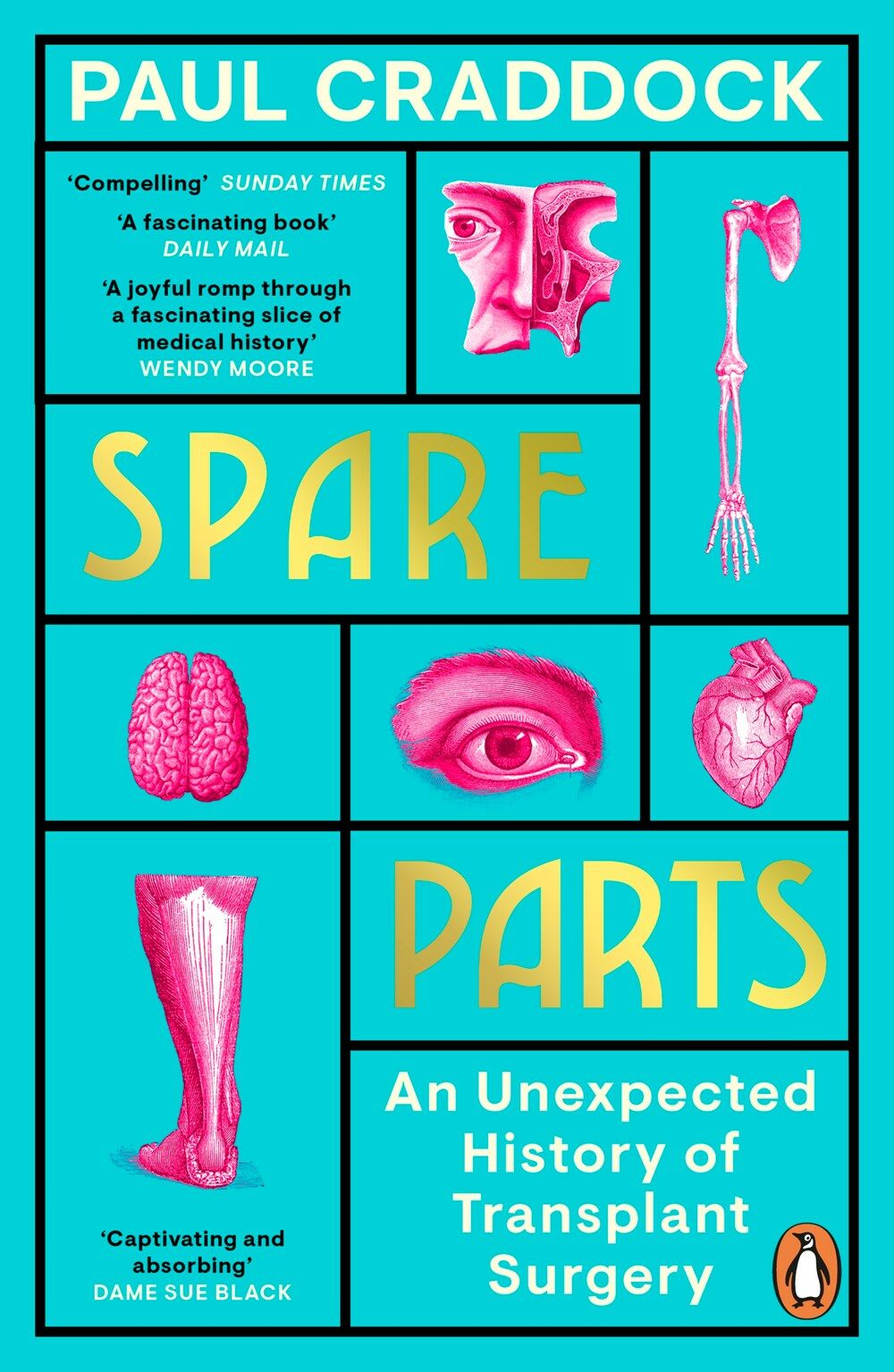 [중고] Spare Parts : An Unexpected History of Transplants (Paperback)