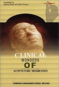 Clinical Wonders of Acupuncture-moxibustion (Paperback)