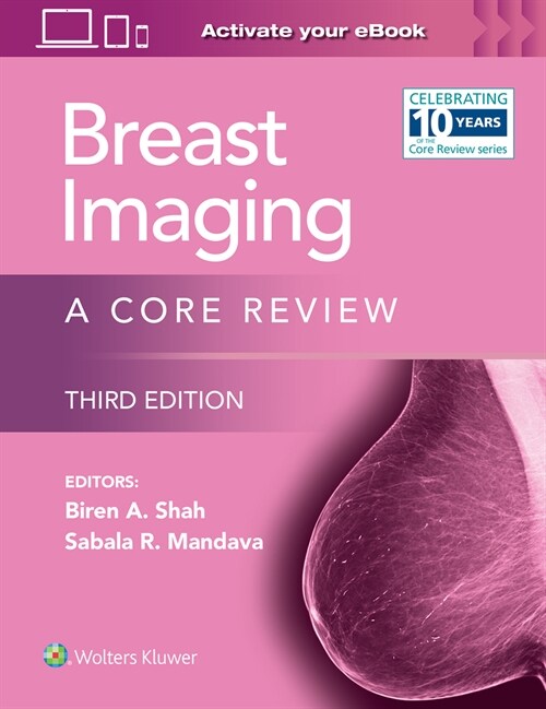 Breast Imaging: A Core Review: Print + eBook with Multimedia (Paperback, 3)