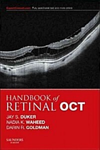 Handbook of Retinal Oct: Optical Coherence Tomography (Paperback)