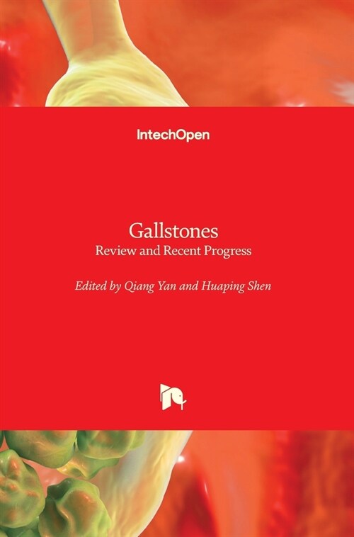 Gallstones : Review and Recent Progress (Hardcover)
