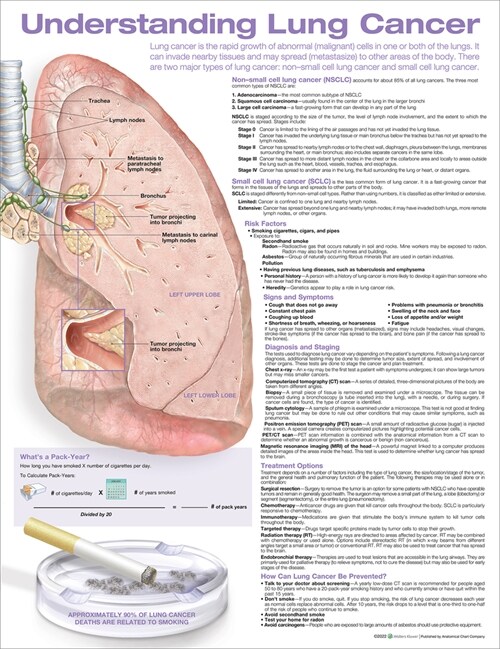 Understanding Lung Cancer Anatomical Chart Laminated (Poster, 2 Revised edition)