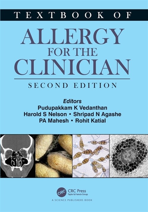 Textbook of Allergy for the Clinician (Paperback, 2 ed)