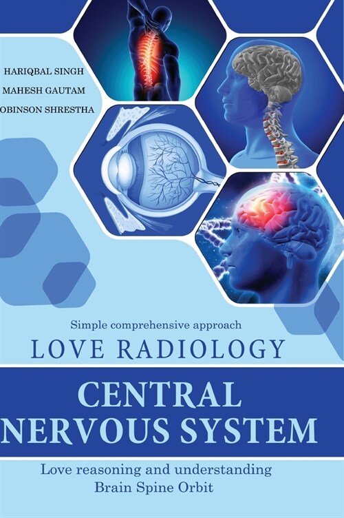 Love Radiology: Central Nervous System (Hardcover)