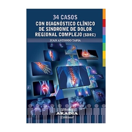 34 CASOS CON DIAGNOSTICO CLINICO DE SINDROME DE DOLOR REGIONAL COMPLEJO (SDRC) (Paperback)