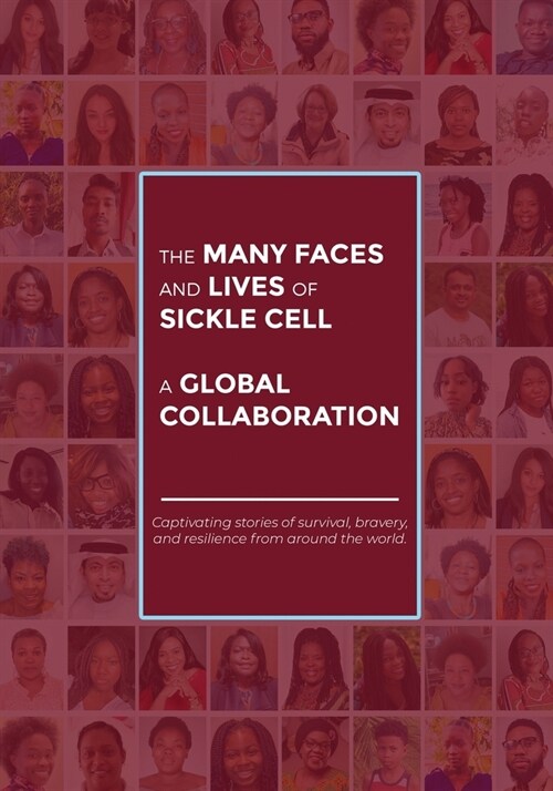 The Many Faces and Lives of Sickle Cell - A Global Collaboration (Paperback)