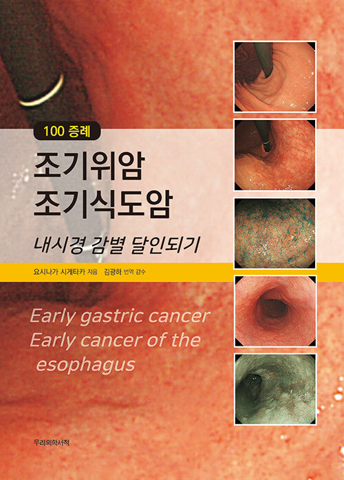 [중고] 100 증례 조기위암 조기식도암
