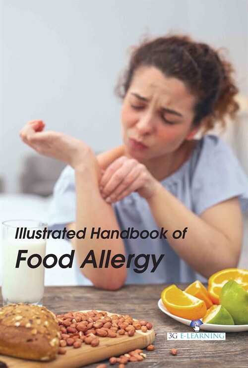 Illustrated Handbook of Food Allergy (Hardcover)