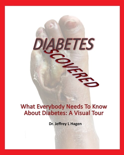 Diabetes Discovered: What Everybody Needs To Know About Diabetes: A Visual Tour (Paperback)