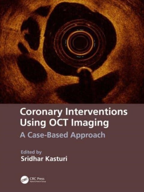 Coronary Interventions Using OCT Imaging : A Case- Based Approach (Paperback)